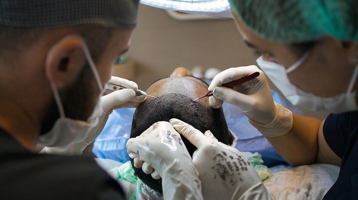 Adana saç ekimi